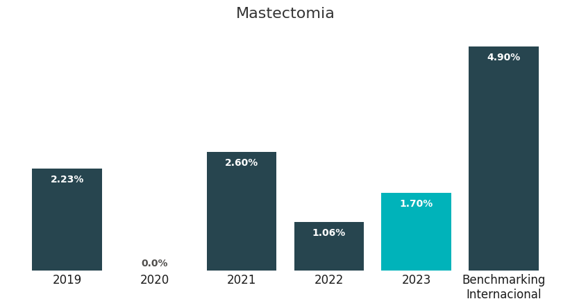 Mastectomia