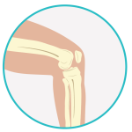 Ilustração de um joelho destacando ossos e cartilagem.